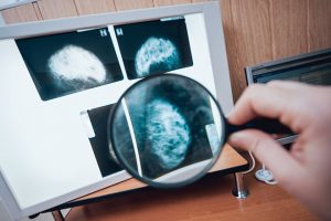 Doctor Examine Mammography Test. Medical Equipment At The Hospital